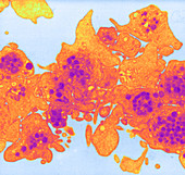 Aggregating Platelets,TEM