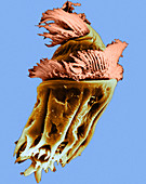 Ophryoscolex Ciliate (SEM)