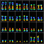 Male karyotype