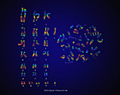 Testicular Feminization Karyotype