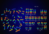 Normal Female Karyotype