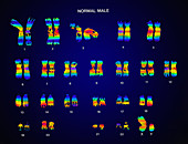 Normal Male Karyotype