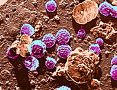 HIV Particles,TEM