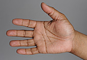 Right Palm of African-American Man