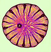 Diatom,TEM