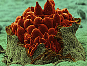 Rose Rust (SEM)