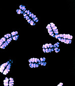 Chromosome from Lymphocyte,SEM
