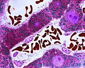 TEM of Liver Section