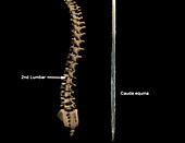 Spinal Column and Cauda Equina