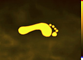 Thermogram of a footprint