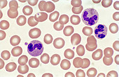 Blood Smear with Neutrophils (LM)