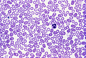 Normal Blood Smear (LM)