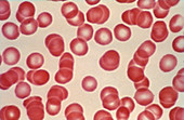 Red Blood Cells (LM)