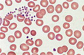 Red Blood Cells and Platelets (LM)