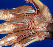 Palm Dissection