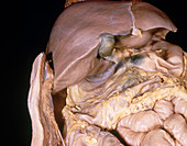 Liver,Gallbladder,and Stomach