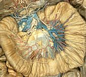Small Bowel and Vessels