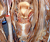 Dissected Larynx