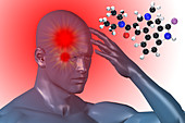 Cluster headache