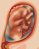 Fetal Growth - Month 6