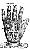 Artificial Hand Designed by Ambroise Pare