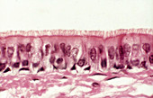 Ciliated Epithelium,LM