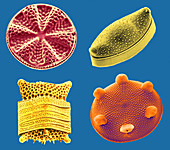 Diatoms (SEM)