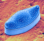 Diatom - Biddulphia
