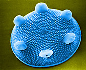 Diatom - Aulacodiscus