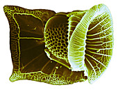 Ornithocercus Dinoflagellate