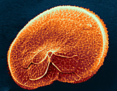 Protoperidinium Dinoflagellate