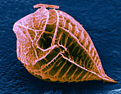 Oxytoxum Dinoflagellate