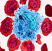 Immature Blood Cells & Macrophage (TEM)