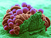 Rose Rust (SEM)