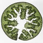 Arenaria Leaf (Light Micrograph)