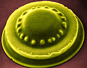 Diatom - Melosira westii