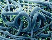 Arthrobotrys oligospora,SEM