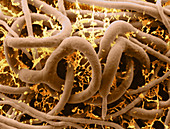 Arthrobotrys oligospora,SEM