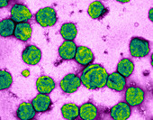 Murine Leukemia Virus,TEM