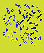 Male Karyotype