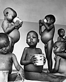 Malnourished Children,Tanzania