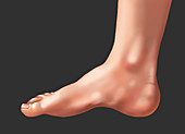 Foot with a High Arch