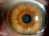 Human Eye