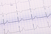 Healthy Electrocardiogram
