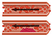 Blood Flow,Illustration