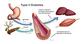 Insulin Glucose Production,Illustration