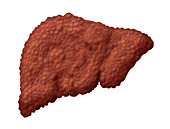 Cirrhotic Liver,Illustration
