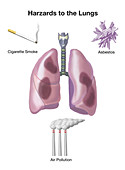 Hazards to the Lungs,Illustration