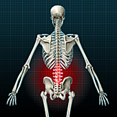 Lower Back Pain,Illustration