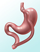 Gastric Bypass Surgery,Illustration